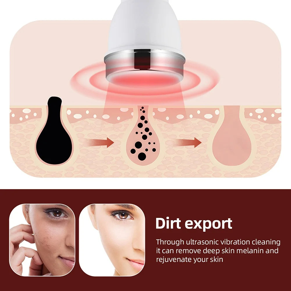 Glow Sculpt™ Ultrasonic Face & Eye Lifting Device