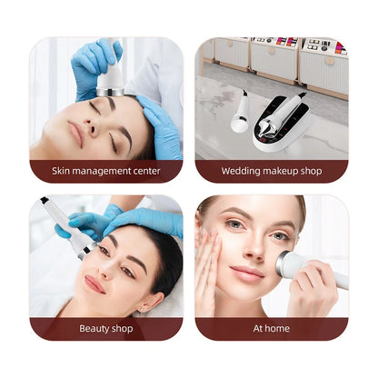 Glow Sculpt™ Ultrasonic Face & Eye Lifting Device