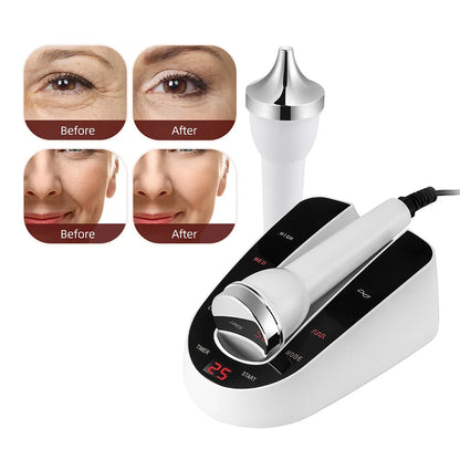 Glow Sculpt™ Ultrasonic Face & Eye Lifting Device